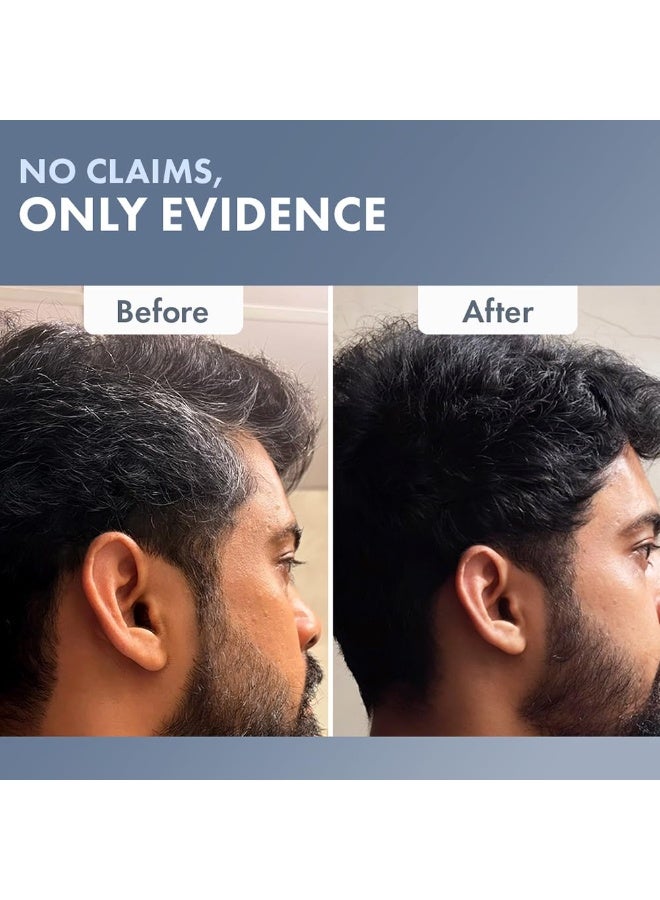 ثريفيكو كريم صبغة شعر دائمة من ثرايف كو | تغطية كاملة للشعر الأبيض بنسبة 100% | خالٍ من الأمونيا | يدوم طويلاً، لا يسبب تلفًا للشعر، ويمنحه نعومة ولمعانًا | بتقنية Hyaplex™ لتقوية روابط الشعر، مناسب لجميع أنواع الشعر | للرجال | لون أسود طبيعي | 70 مل (عبوة من قطعتين) - Image 2